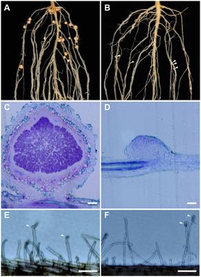 The Soybean Rfg1 Gene Restricts Nodulation by Sinorhizobium fredii USDA193